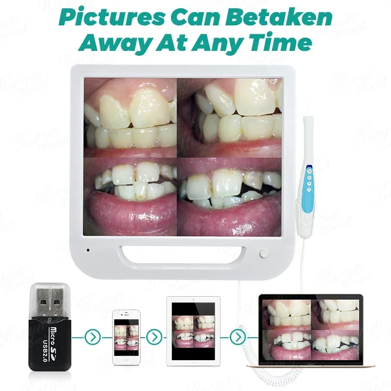 New in 8 Million Pixel Den tal Intraoral cam era with 17 Inch HD Screen 6Led Light cam era Intraorale Con mon itor