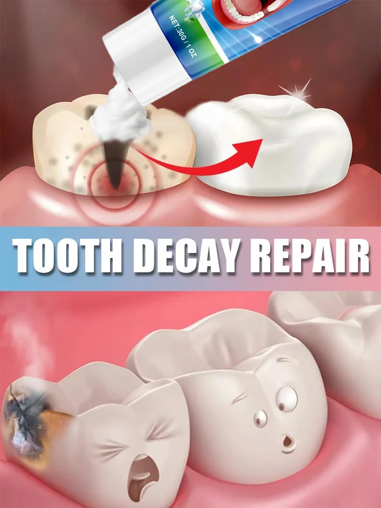 

Tooth decay repair