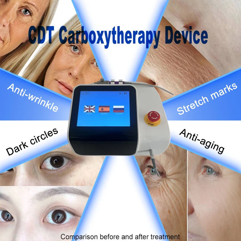 

CDT Carboxytherapy Device Plus Skin Breathing Beauty CO2 Machine Remove Stretch Marks Reduce Wrinkles And Reduce Dark Circles