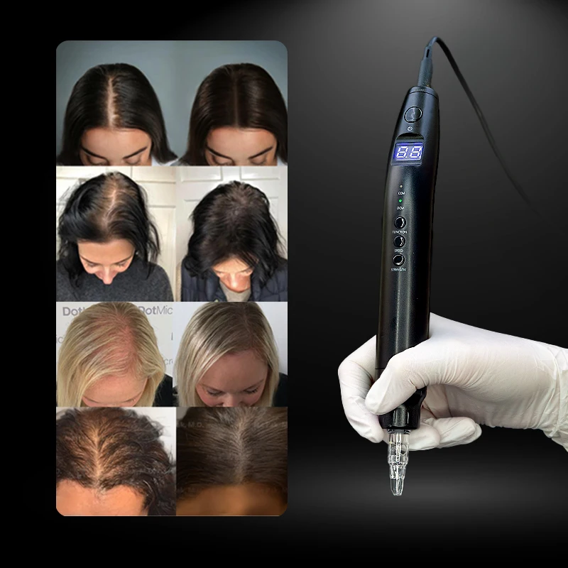 Thumbnail 2 - #8 Latest PMU Machines Offers