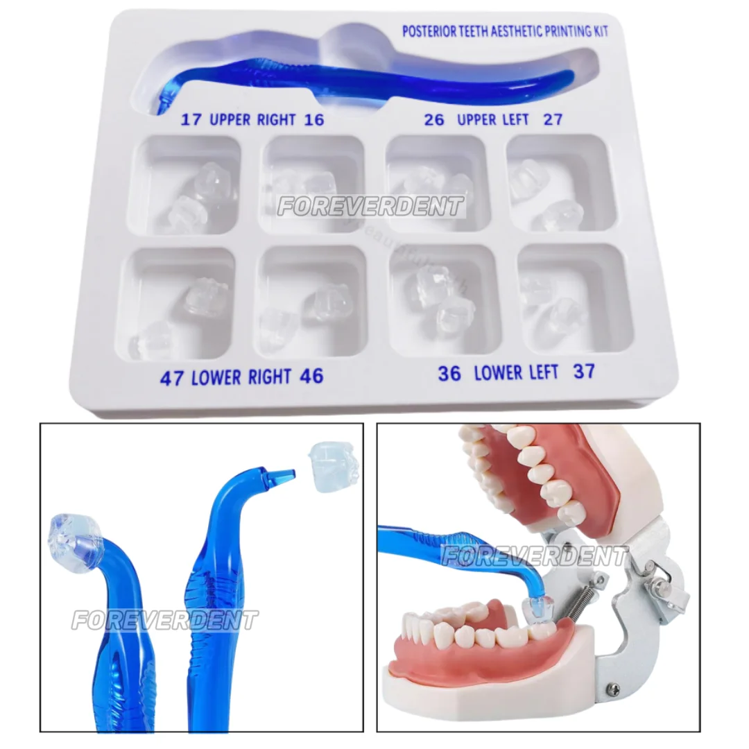 

1~10Box Dental Mould Posterior Teeth Veneers Partner Restoration Kit Composite Restore Molar Groove 134