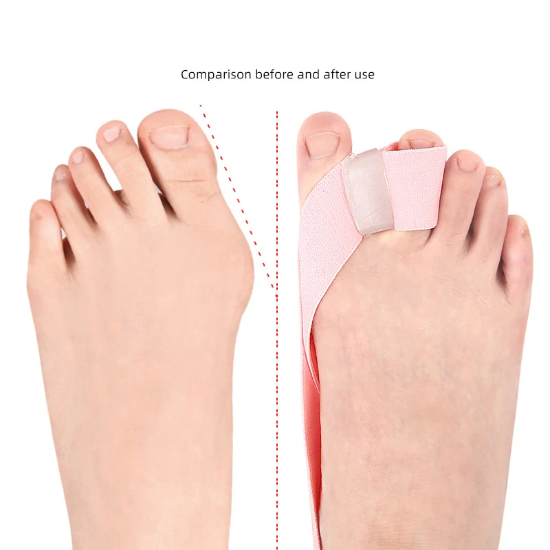 Hallux Valgus Corrector Thumb Valgus Corrector Tension Strap Pain Relief Toefinger Separator Toe Straightener Tool Foot Care