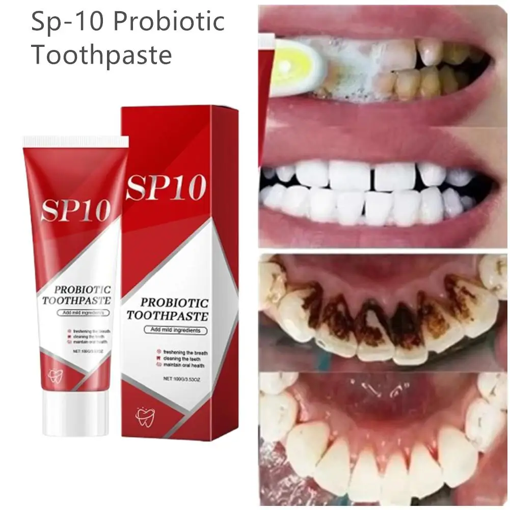 Sp-10 100g ยาสีฟันโปรไบโอติกฟันลบคราบจุลินทรีย์ฟัน Whitener Oral สุขอนามัย Clean Fresh Breath Oral Care ยาสีฟันสูตรเกลือผสมฟลูออไรด์ผสานพลังสมุนไพรฟันขาวสะอาดลดกลิ่นปาก