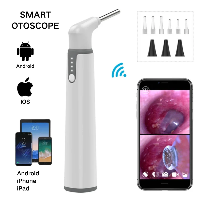 3.9mm Ear Scope Camera with Dual View Wifi Digital Otoscope 720P with 6 LED Lights for Kids and Pets work with IOS Android