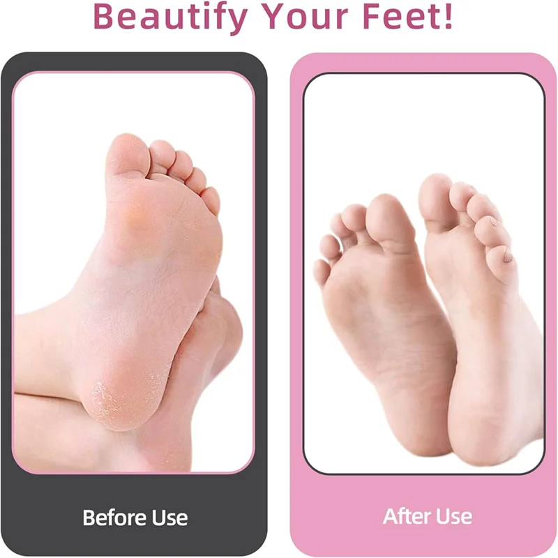 เท้าแคลลัสRemover ProfessionalแคลลัสRemover Forfeet With60pcsกระดาษทรายแผ่นBlacka83x