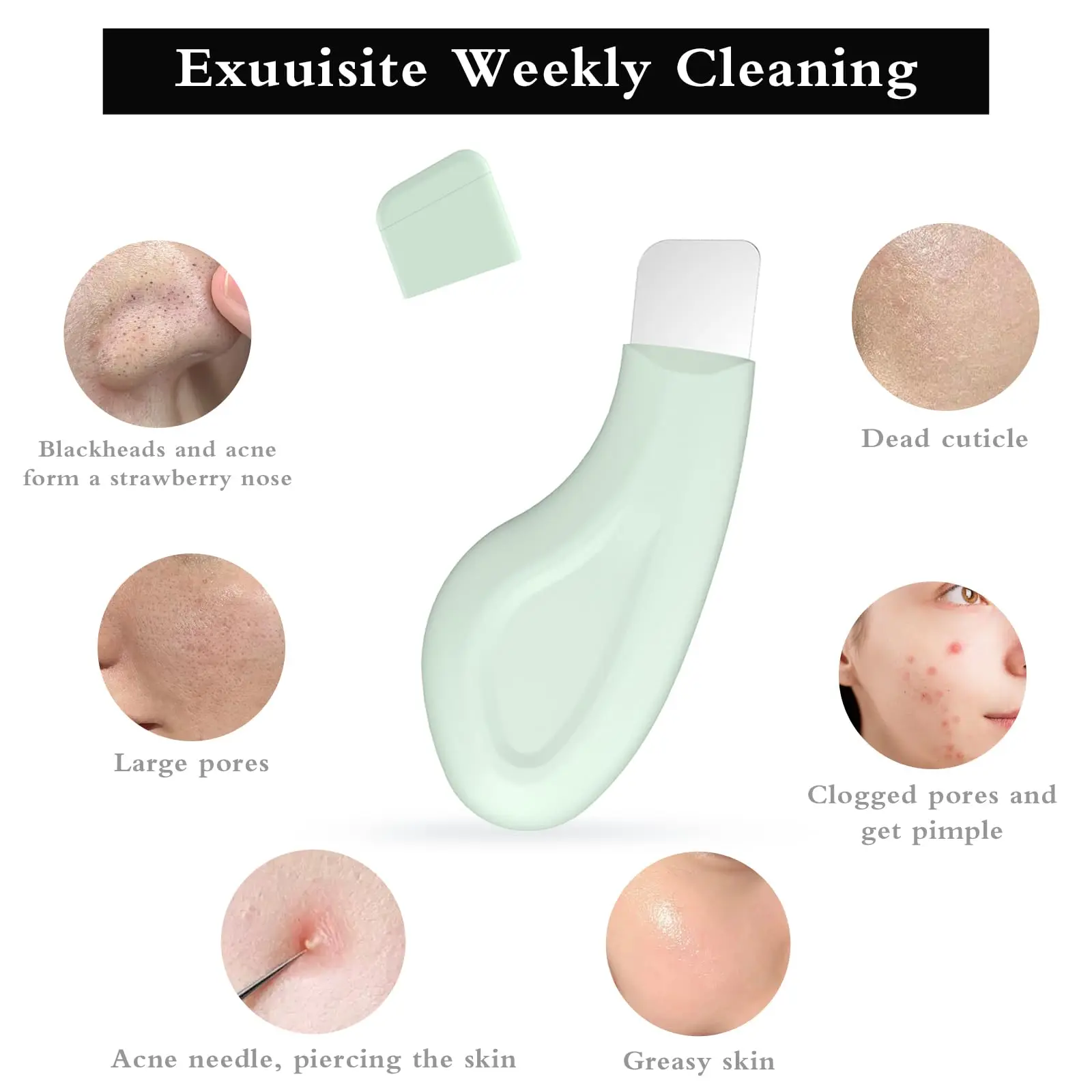 Profesjonalne narzędzie do głębokiego oczyszczania porów, usuwania zaskórników i komedonów z nosa i twarzy - Oczyszczacz porów, narzędzia do pielęgnacji skóry, hit sprzedaży
