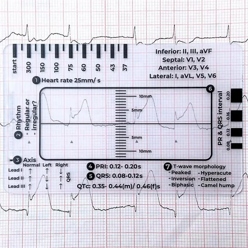 

WO-ECG 7-ступенчатая линейка, 7-ступенчатая линейка ЭКГ для тердавления ЭКГ/ЭКГ, линейка по сравнению ЭКГ, измерительный инструмент для штангенциркулей ЭКГ