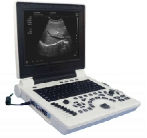 

Diagnostic Ultrasound System Black and White Portable Digital Ultrasound Scanner Machine For Hospital