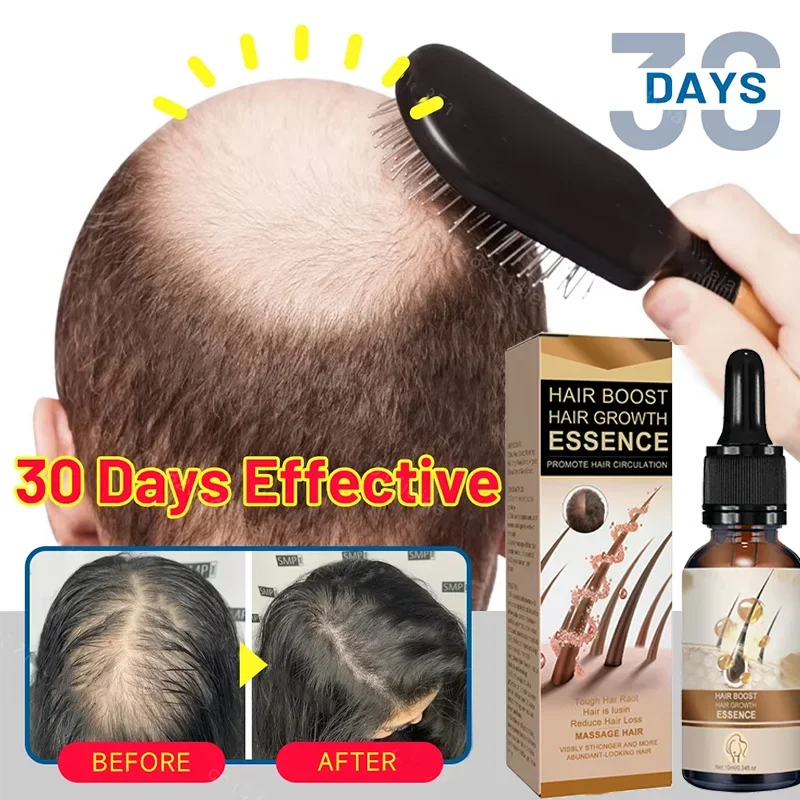 

Anti Hair Loss Scalp Treatment Serum Beauty Health Products Fast Hair Growth for Men Women Ginger Oil Care