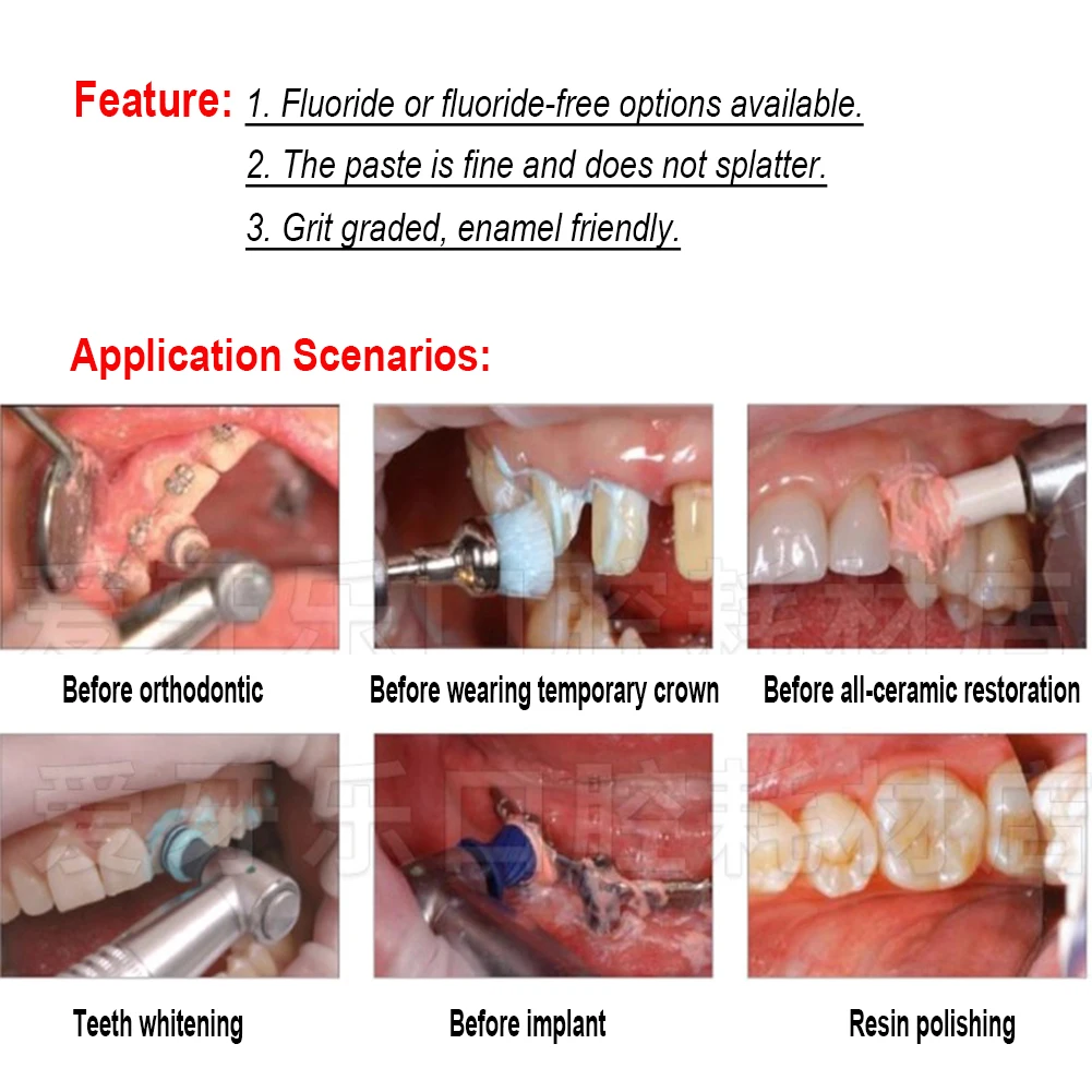 80g/pc Ivoclar Vivadent Polishing Paste Fine Medium Coarse Grit Fluoride-free Professional Tooth Cleaning Dental Resin Remove