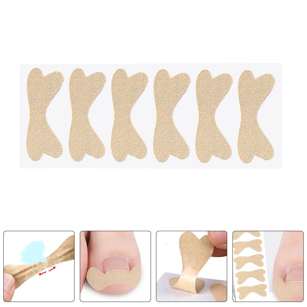 

10pcs Ingrown Toenail Corrector Self Adhesive Patches Toe Protectors Curved Nail Correction Longlasting Toe Tape Foot Care Tool