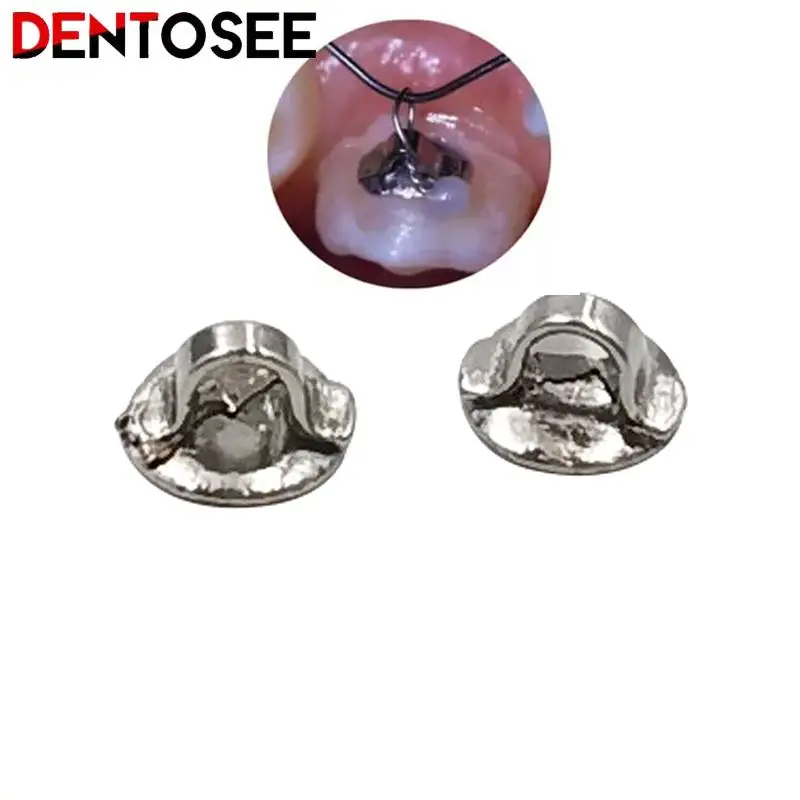 10Pcs/pack Dental Orthodontic Mesh Lingual Buttons Bottom Perforated Connection Tongue Side Buckle Dental Consumables