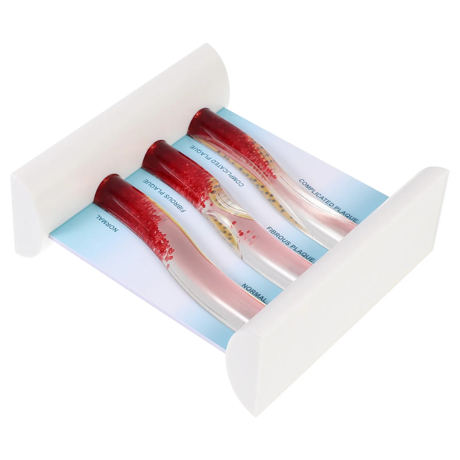 

Учебный анатомический динамический пластиковый манекен сосудов крови с липопротеинами низкой плотности для демонстрации сердечно-сосудистой системы