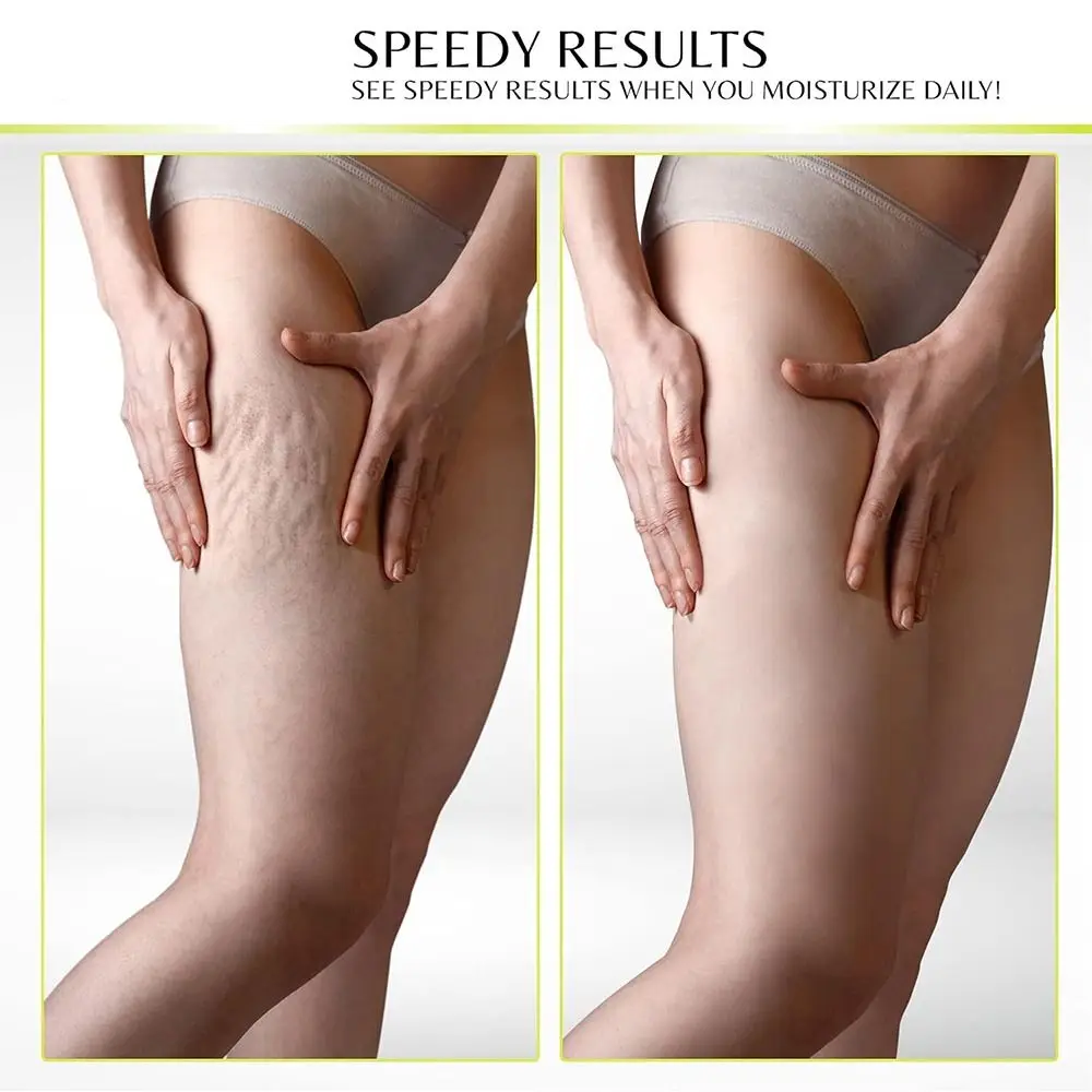 Kollagen Retinol Kollagen Gesichtscreme Feuchtigkeitsspendende Hyaluronsäure Vitamin C Körperlotion Straffende und Aufhellung Anti Aging