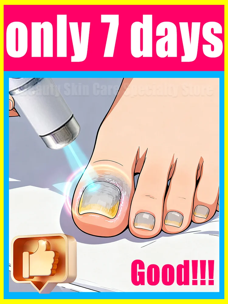 

2025 Trending Hits: Nail Cleaning Tools, Blue Light Laser Apparatus – Root Repair Updated to the Second Gen