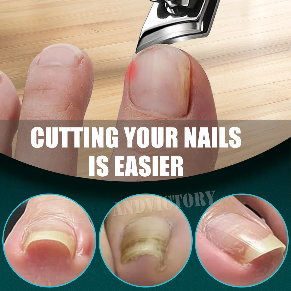 1 pçs cortador de unhas lâmina curvada inclinada toe cortador de unhas encravadas cortador de unhas cabeça angular cortador de unhas