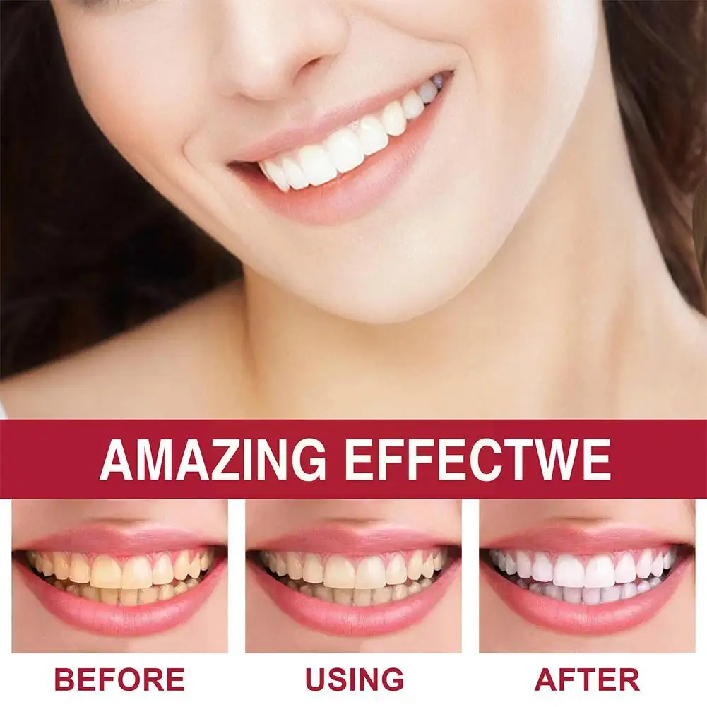 Creme dental probiótico para remoção de mancha, creme dental clareamento, Prevenção da cavidade, Clareamento dos dentes, Todas as séries, M5Z3, Novo