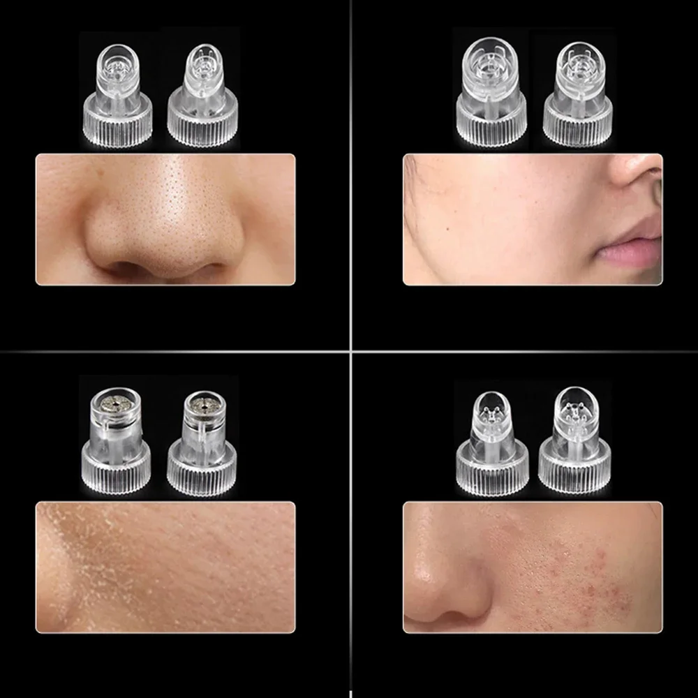 Punta de 9 Uds para herramienta de cuidado de la piel Hydro Facial dermoabrasión para H2O2 agua oxígeno Jet Peel accesorios de microdermoabrasión hidrafacial