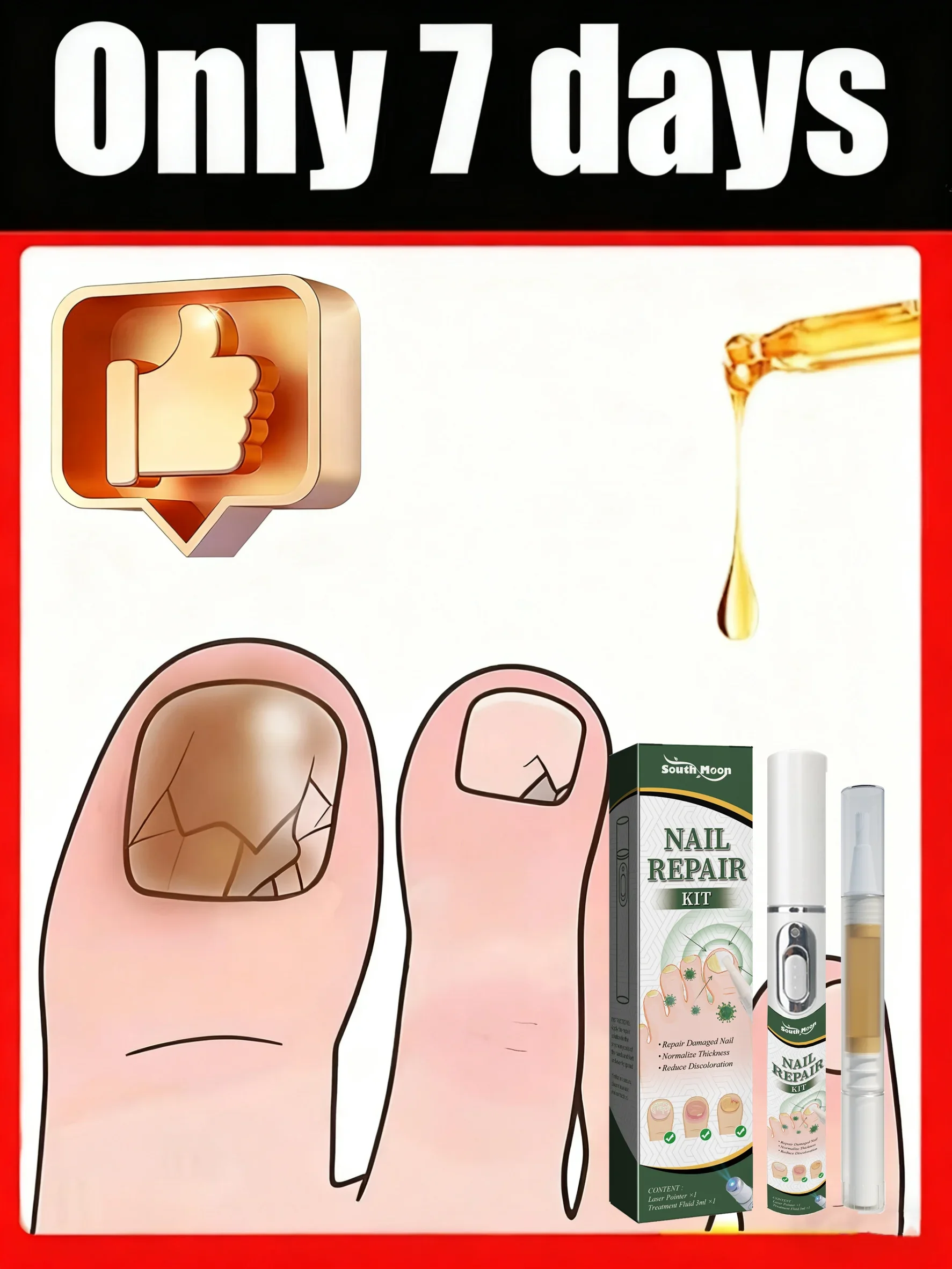 

2025Safe, безболезненное лазерное лечение поврежденных ногтей