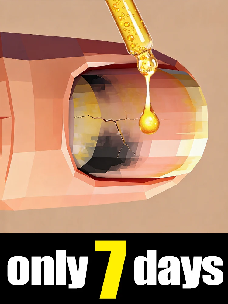 

2nd generation Foot Care Tool Portable Heel Callus Remover.Nail Fungus Grinding Tools nail file 2026 HOT