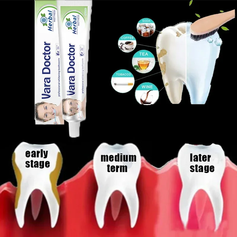 

Remover Dental Calculus Whitening Teeth Mouth Odor Removal Bad Breath Preventing Periodontitis Oral Health Care New 2024