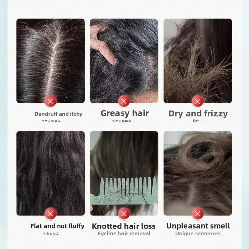 300ml Improved Frizz Purifying Scalp Care Shampoo Anti-Dandruff Oil Control Deep Cleansing Itch Relief Hair Care Product