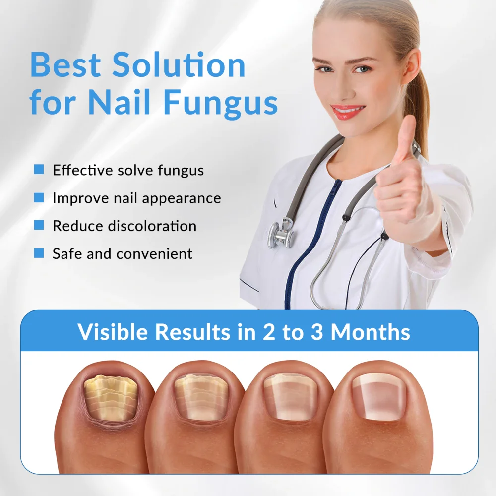 Dawfek 905nm & 470nm Toenail Fungus Treatment Laser Therapy Device for Fungal Nail Repair Care Professional Onychomycosis Repair
