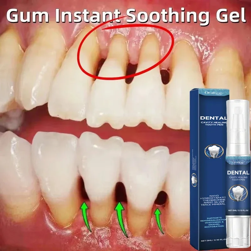 Suero de Gel para encías dañadas, reparación rápida, alivia la alergia dental dolorosa, limpieza dental de caries, pasta de dientes, limpieza profunda de manchas de dientes