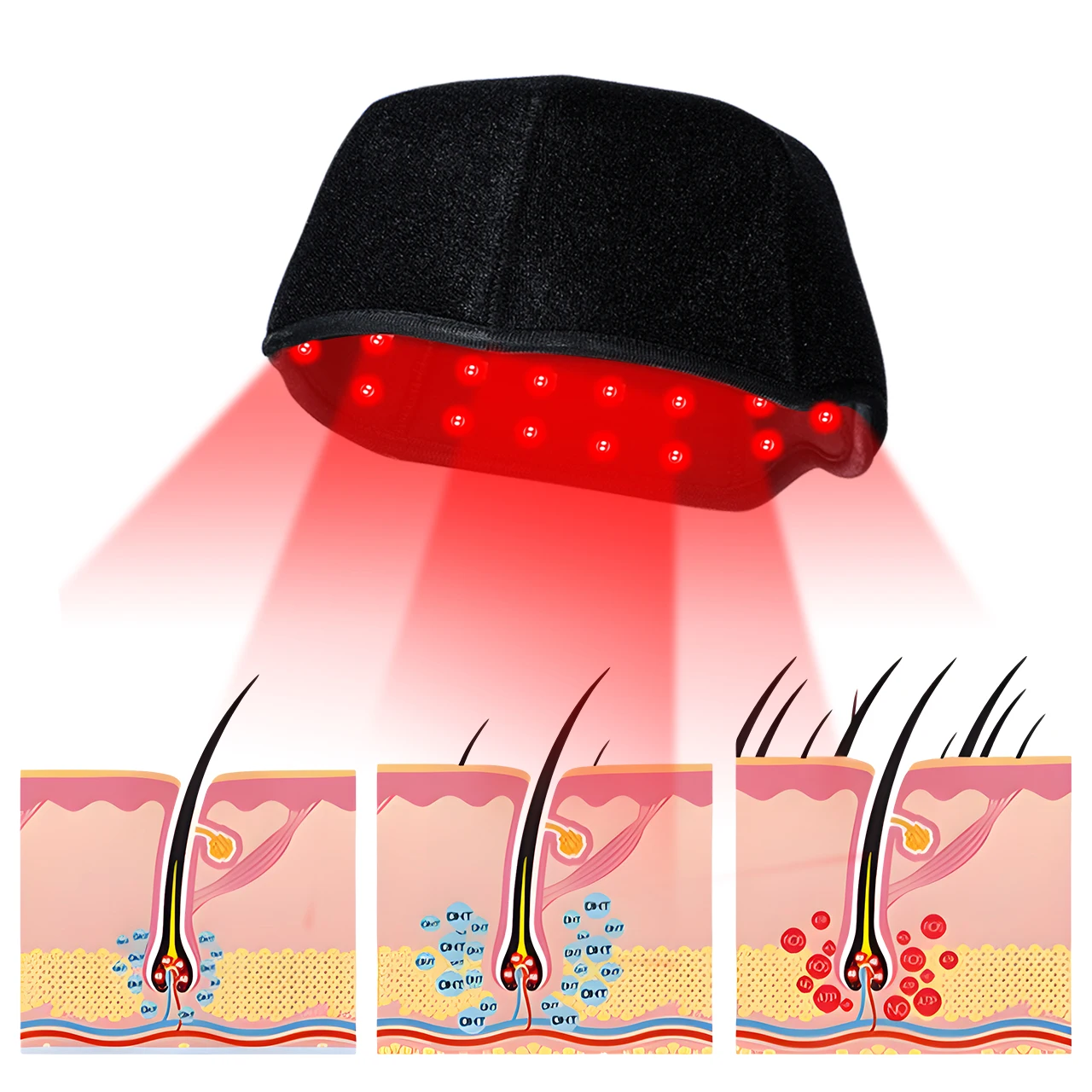 Phototherapy Electric Led Red Infrared Light Therapy Anti Hair Lose Hat Promote Hair Regrowth Laser Cap Heating for Home Use