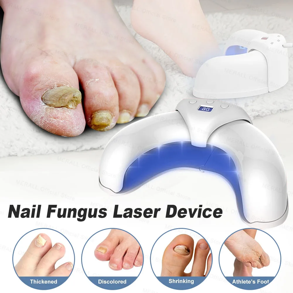 

Toenail Fungal Nail Laser Treatment Repair Fast Nails Fungus Onychomycosis Repair Foot Fingernail Removes Nail Fungus Device