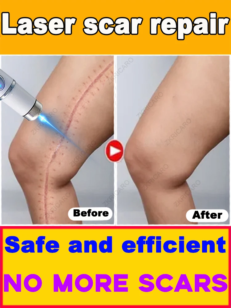 傷跡を治療し、美しくなり、自信を取り戻しましょう