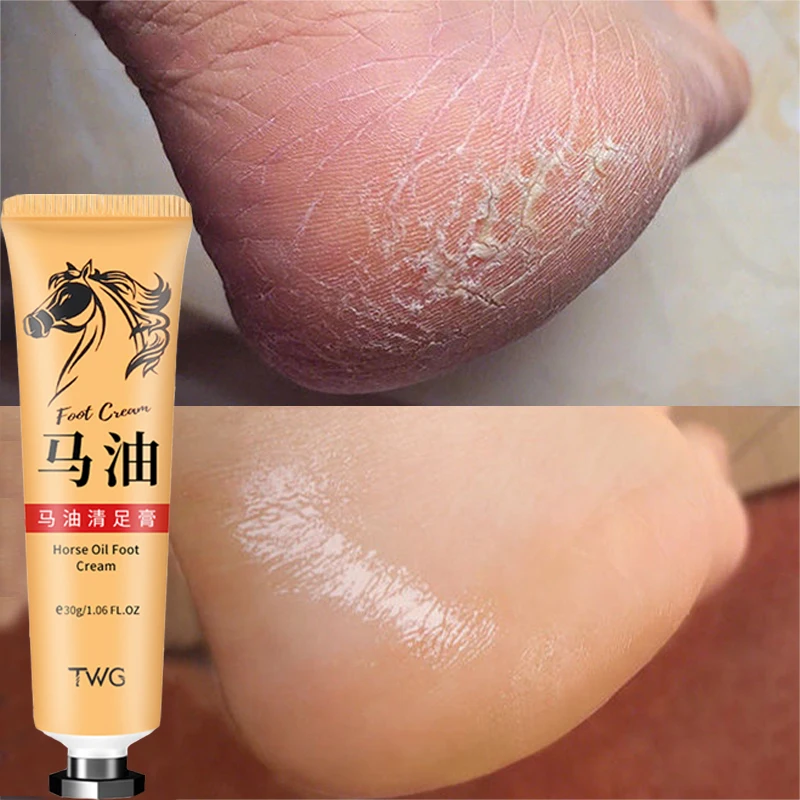 Crème à l'huile de cheval anti-fissure pour les pieds et les talons, soin réparateur, lisse, enlève les callosités de la peau, anti-séchage, 30g