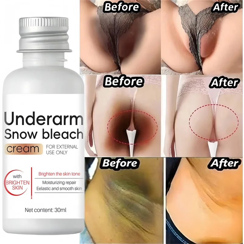 Whitening Cream Private Parts Underarm Bleaching Serum Whiten Butt Knee Brighten Inner Thigh Intimate Parts Dark Remove Melanin