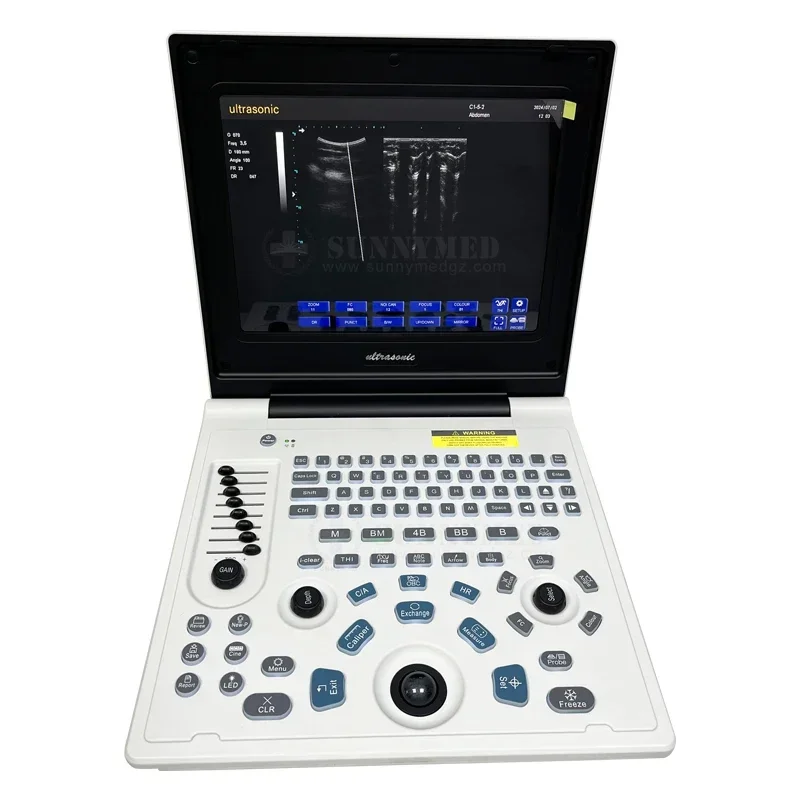 SY-AX50-1 Color PW Ultrasound Echo Machine Clinic Diagnostic Ecografo Digital Cardiac B/W PW Ultrasound Scanner