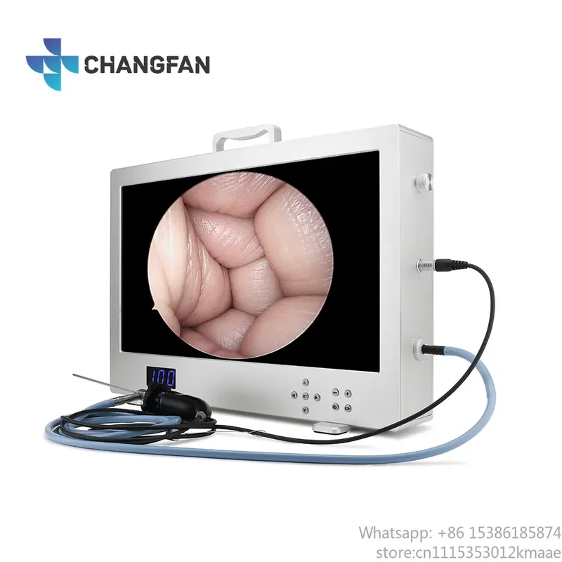 ENT Endoscope Camera System All-in-One 24-inch Full HD 1080P Medical Endoscopy System with Integrated Light Source