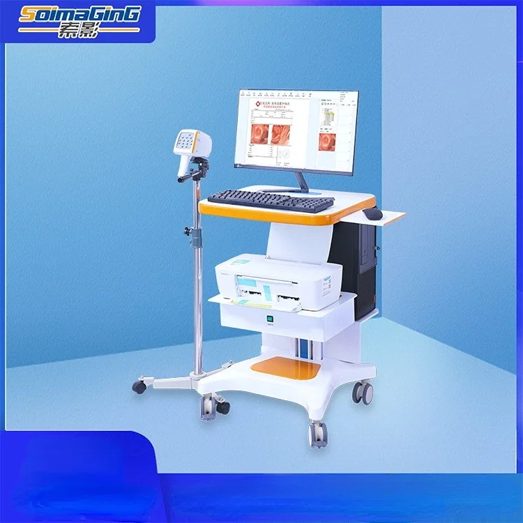 Gynecological examination Digital electronic colposcopy Private examination Hospital clinic equipment