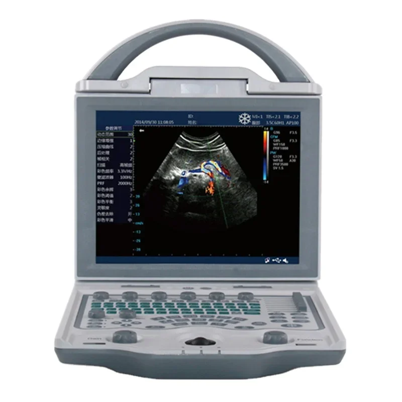 High End Portable 4D Color Doppler Laptop Veterinary Ultrasound Scanner Sheep Ultrasound Machine