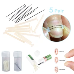 10/50pcs Ingrown Toenail Corrector Tools Ingrown Toe Nail Treatment Elastic Patch Sticker Straightening Clip Brace Pedicure Tool