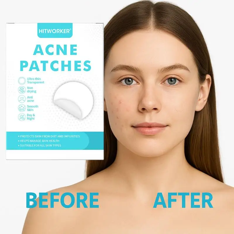 Hoyytu 180/360/720Pcs Hydrocolloid  Patches Per Box Alcohol-Free Gentle Non-Irritating Blemish Covering Sticker For Pimples