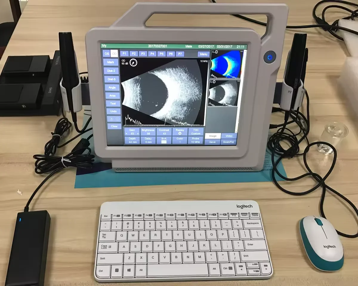 Best Price Ophthalmic Ultrasound A/ B Scan For Biometry Eye Test In Ophthalmology