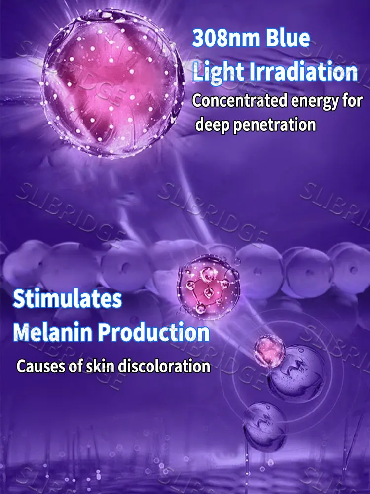 Caneta de luz azul remove rapidamente o vitiligo, uma ferramenta mais vendida para cuidados com a vitiligo.