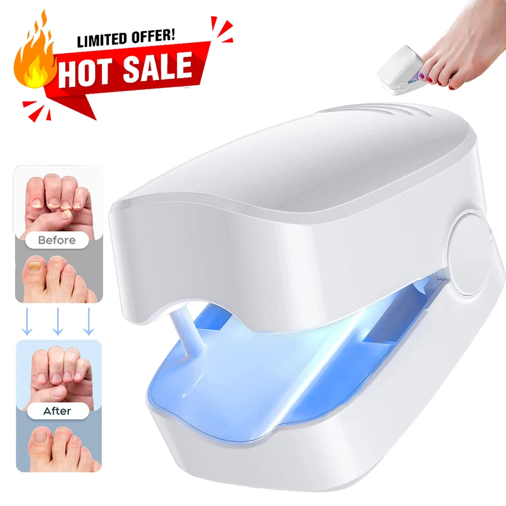 Nail Fungus Treatment Laser Device for Cleaning Onychomycosis USB Charge Anti Fungal Repair Damaged Discolored Thick Fingernails