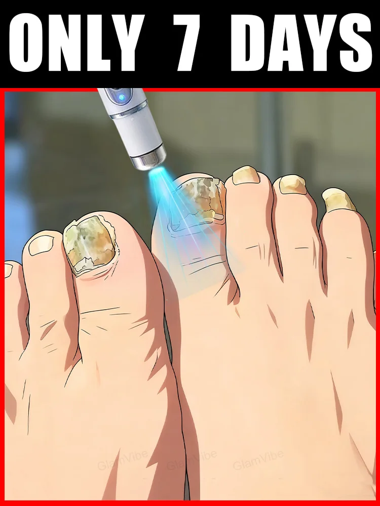 

Лазерное лечение ногтей и удаления онихомикоза