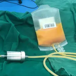 2-pc Pack Single Use 200ml Medical PVC Storage Bag for Autologou Fat/Autologous fat transfer