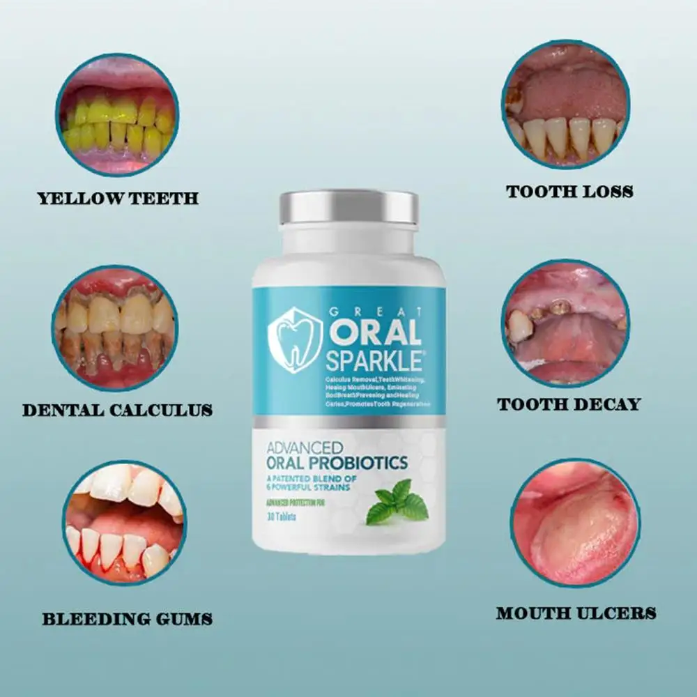 Probióticos sólidos creme dental comprimidos, clareamento dos dentes, carvão vegetal, remove manchas de fumaça, mau hálito, bochechos frescos, Oral Care