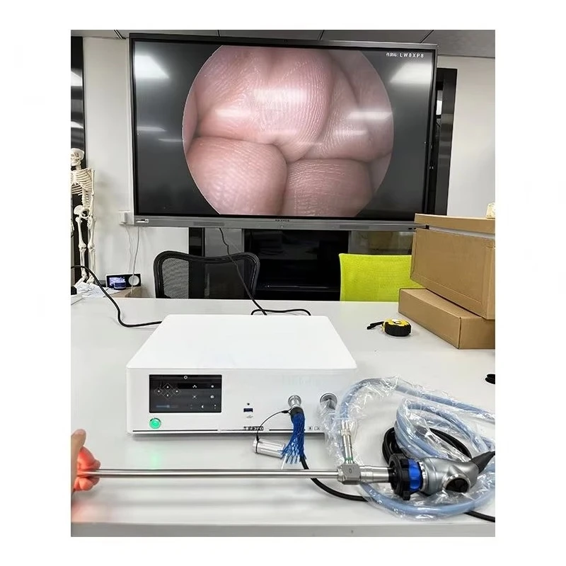 Veterinary Endoscopy Otolaryngoscope Set 1080p Medical Cholangioscopy System Endoscopy Unit Veterinary Portable Usb Endos