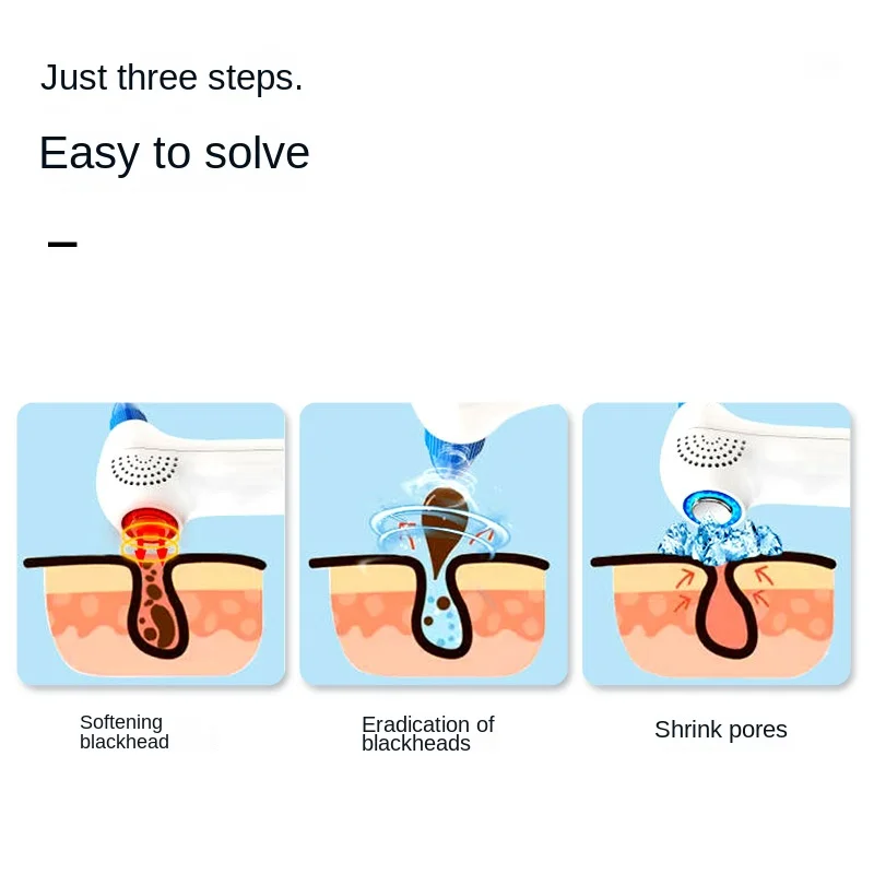 เครื่องมือสิวหัวดําร้อนและเย็น สิวหัวดํา ดูดไฟฟ้า เครื่องมือความงามในครัวเรือน การบีบอัดร้อนและเย็น บทนํา