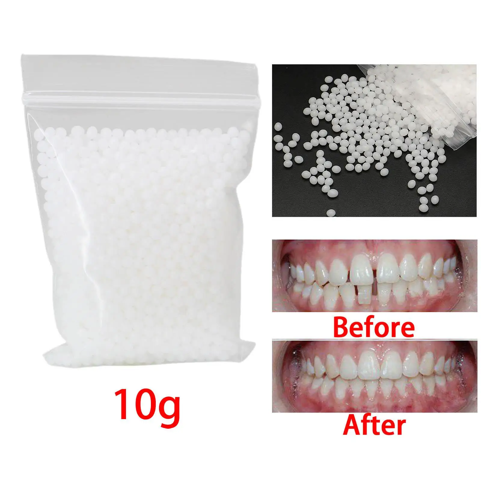 10G Temporary Tooth Repair Kit Denture Fake Veneer Fix Broken