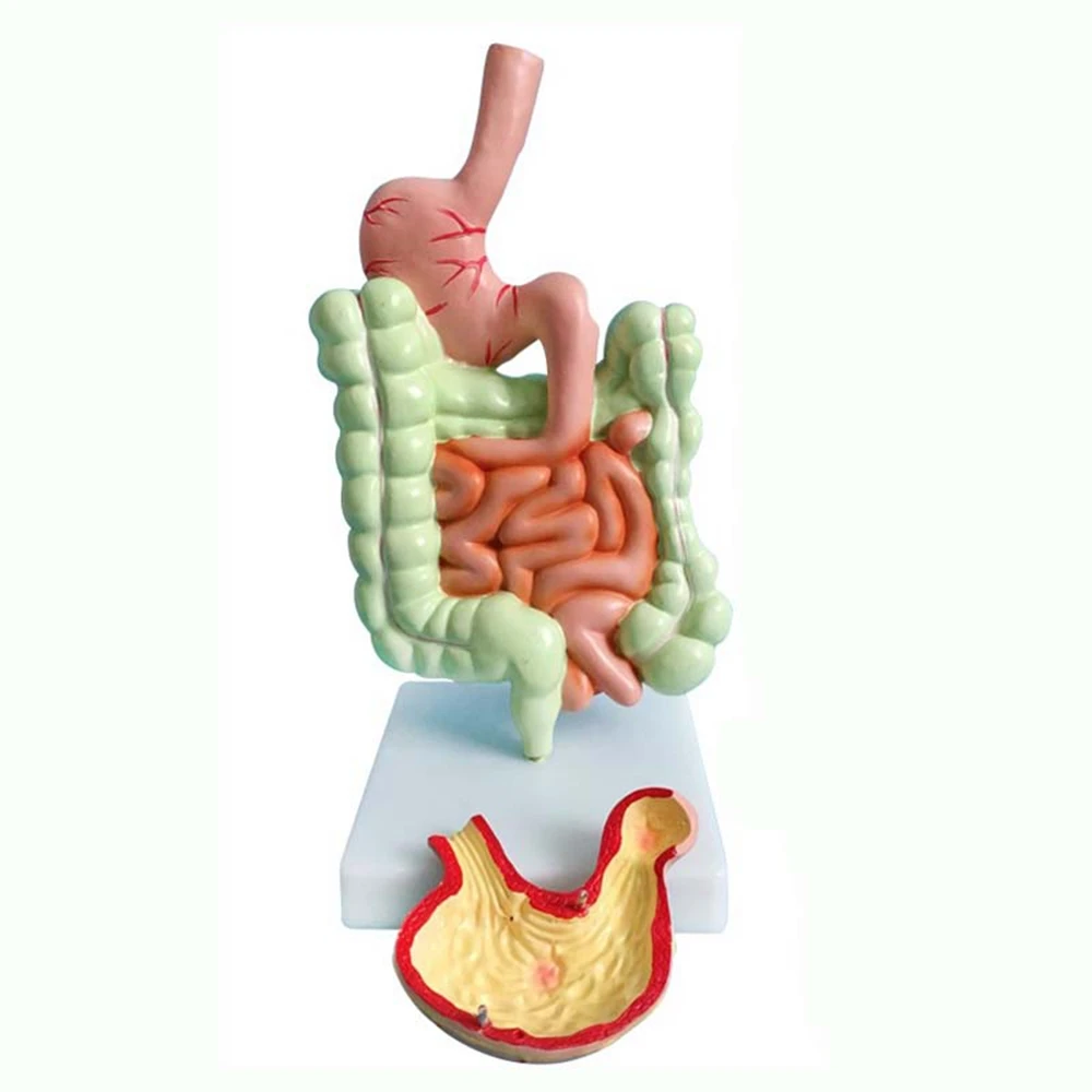 Imagem -02 - Modelo do Sistema Digestivo Humano Anatomia Intestino Grande Reto do Cecum Estrutura dos Órgãos Internos Estômago