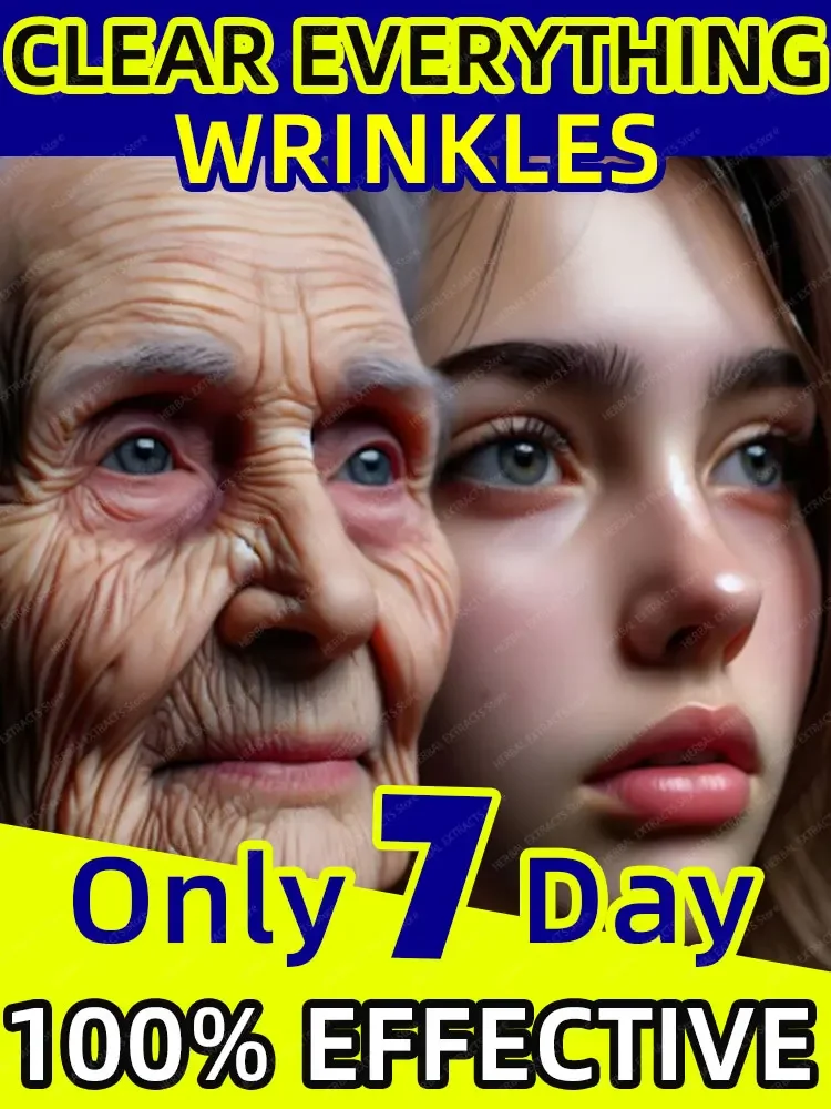 

Laser wrinkle repair